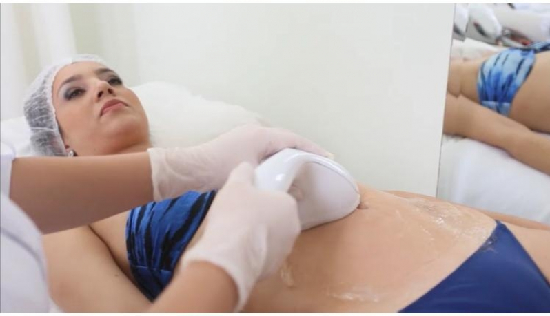 Massagem Redutora de Gordura Vila Versoni - Massagem Redutora na Barriga