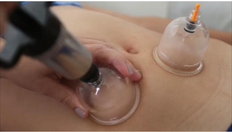 Onde Faz Massagem Redutora de Gordura Vila Maria - Massagem Modeladora Redutora