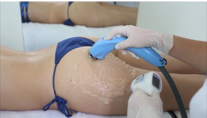 Onde Tem Massagem Redutora de Celulite Vila Santos - Massagem Redutora Modeladora