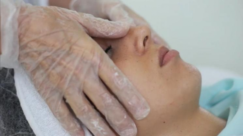 Rejuvenescimento Facial Estético Vila Mazzei - Tratamento para Rejuvenescimento Facial