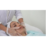 microagulhamento acne agendamento Vila Santa Luzia