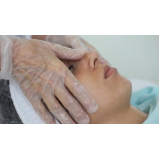 rejuvenescimento facial tratamento agendamento Vila Minosi
